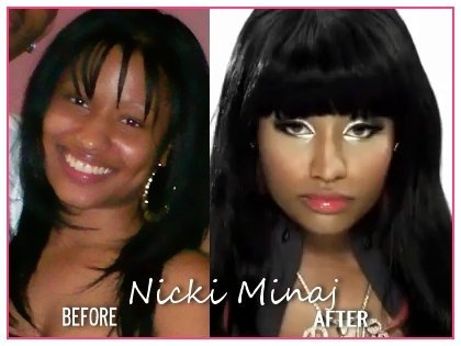 nicki minaj plastic surgery pictures. Nicki Minaj Bleaching Plastic